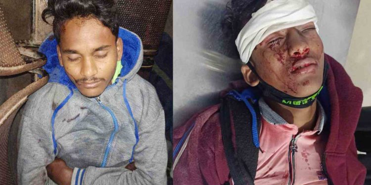 ସାଇକେଲ ସାଇକେଲ ଦୁର୍ଘଟଣା, ଦୁଇ ଗୁରୁତର  କଟକ ବଡ ଡାକ୍ତରଖାନା ରେ ଭର୍ତ୍ତି