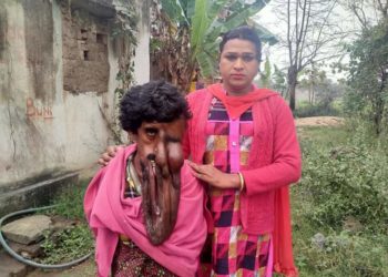 ସରକାର କେବେ କୁଶଧ୍ୱଜଙ୍କ ଦୁଃଖ ବୁଝିବେ ?