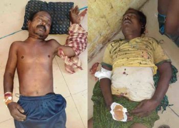 କାଜୁ ଜଙ୍ଗଲକୁ ନେଇ ୨ ମୃତ ୨୦ ଆହତ, ୬ ଜଣ ଗୁରୁତରଙ୍କୁ ଭୁବନେଶ୍ୱର ସ୍ଥାନାନ୍ତର