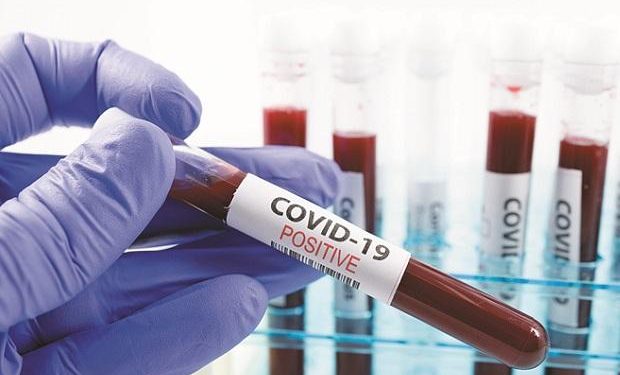 ବସ୍ତା ବ୍ଲକରେ ୧, ବାଲେଶ୍ୱର ଜିଲ୍ଲାରେ ୩୩, ଜିଲ୍ଲାର ମୋଟ ଆକ୍ରାନ୍ତ ସଂଖ୍ୟା ୯୦