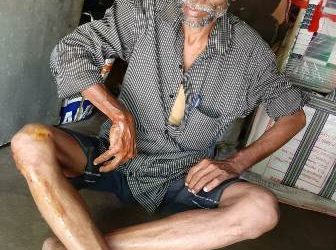 ସାଇକେଲକୁ ଧକ୍କାଦେଲା ଟାଟାଏସି ; ଜଣେ ଗୁରୁତର