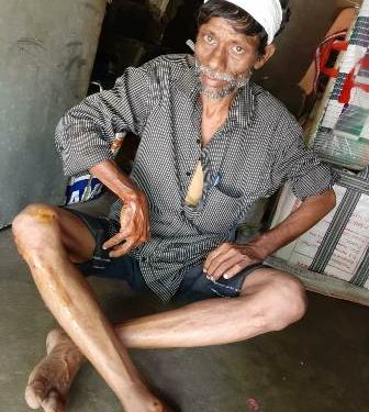 ସାଇକେଲକୁ ଧକ୍କାଦେଲା ଟାଟାଏସି ; ଜଣେ ଗୁରୁତର