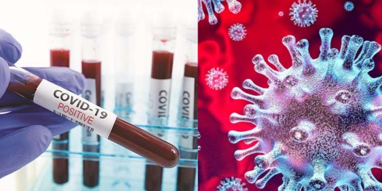 ଗଜପତି ଜିଲ୍ଲାରେ ଆଉ ୧୫ କରନା ପୋଜେଟିଭ ଚିହ୍ନଟ ହେବା ପରେ : ଜିଲ୍ଲାରେ କରନା ଆକ୍ରାନ୍ତ ସଂଖ୍ୟା ବଢ଼ି ୯୯ରେ ପହଞ୍ଚିଛି ।