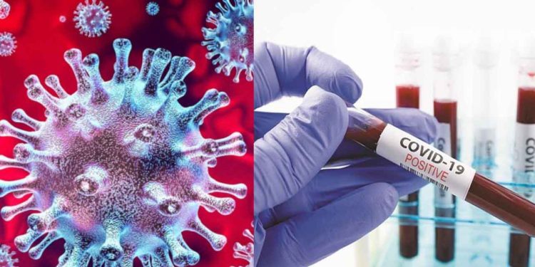 ଓଡ଼ିଶାରେ ୩,୫୩,୮୨୪ ଟି ନମୁନା ପରୀକ୍ଷା କରାଯାଇଛି, ୧୪,୮୯୮ ଜଣ ପଜିଟିଭ୍‌ ଚିହ୍ନଟ, ୧୦,୪୭୬ ଜଣ ସୁସ୍ଥ,୭୭ ଜଣ ମୃତ୍ୟୁ ହୋଇଛି ।