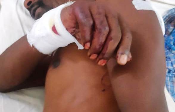 ଢେଙ୍କାନାଳ ; ତାଳବରକୋଟ୍ ଗ୍ରାମରେ ଭୁଜାଲି ଆକ୍ରମଣରେ ଯୁବକ ଗୁରୁତର