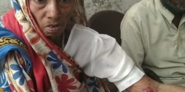 ମାହାଙ୍ଗା : ପାଗଳକୁକୁର କାମୁଡାରେ 10 ରୁ ଉର୍ଦ୍ଧ ଲୋକ ଆହତ ହୋଇଛନ୍ତି