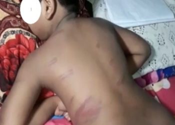 ପାଠ ପଢାଉଥିବା ବେଳେ ଟିଉସନ ସାରଙ୍କ ମାଡ଼ ପାଇଁ – ଛାତ୍ର ଗୁରୁତର (ଟିଉସନ ସାର ସାବଧାନ)