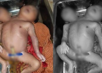 କେନ୍ଦ୍ରାପଡ଼ାର ଏକ ଘରୋଇ ନର୍ସିଂହୋମ୍‌ରେ ଏକ ଅଦ୍ଭୁତ ଶିଶୁ କନ୍ୟା ଜନ୍ମ ହୋଇଛି