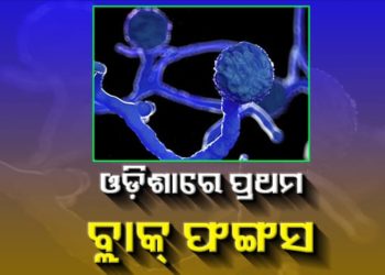 ଓଡ଼ିଶାରେ ମ୍ୟୁକୋରୋମାଇକୋସିସ୍‌ ବା ବ୍ଲାକ ଫଙ୍ଗସରେ ସଂକ୍ରମିତ ହେବା ଗୋଟିଏ କେସ୍‌ ସାମନାକୁ ଆସିଛି