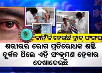 କରୋନା କାଳରେ ଚିନ୍ତା ବଢ଼ାଇଲାଣି ଆଉ ଏକ ନୂଆ ସଂକ୍ରମଣ – ବ୍ଲାକ୍ ଫଙ୍ଗସ୍