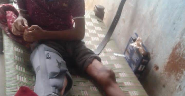 ସହଯୋଗ ହାତ ବଢାଇଲେ ବାବୁଲି ମଣ୍ଡଳ,ସୁସ୍ଥ ହେଲେ ଘନଶ୍ୟାମ