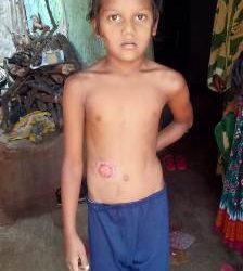 ହରିଶଙ୍କର ଗ୍ରାମ ଚାନ୍ଦିନୀ ପ୍ରଧାନ ( ୮) ମଳ ଦ୍ଵାର ଅପରେସନ ପାଇଁ ସହଯୋଗ କଲା ସେବା ଚେରି ଟେବୁଲ୍ ଟ୍ରଷ୍ଟ