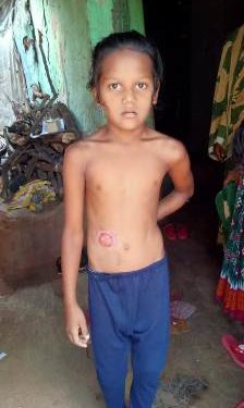 ହରିଶଙ୍କର ଗ୍ରାମ ଚାନ୍ଦିନୀ ପ୍ରଧାନ ( ୮) ମଳ ଦ୍ଵାର ଅପରେସନ ପାଇଁ ସହଯୋଗ କଲା ସେବା ଚେରି ଟେବୁଲ୍ ଟ୍ରଷ୍ଟ