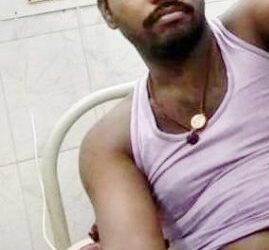 ଚିକିତ୍ସାରେ ଅବହେଳା ଓ ସରକାରୀ ସହାୟତାରୁ ବଂଚିତ ହୋଇଥିବା ଅଭିଯୋଗ କରି ବିଧାନସଭା ଆଗରେ ବିଷ ପିଇ ଓ ହାତକାଟି ଆତ୍ମହତ୍ୟା ଉଦ୍ୟମ ଯୁବକର ମୃତ୍ୟୁ ଘଟିଛି