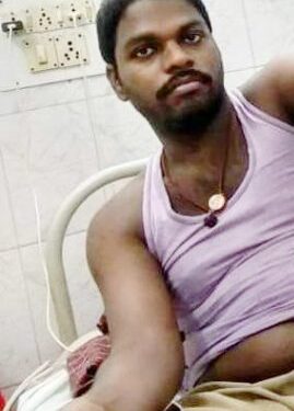 ଚିକିତ୍ସାରେ ଅବହେଳା ଓ ସରକାରୀ ସହାୟତାରୁ ବଂଚିତ ହୋଇଥିବା ଅଭିଯୋଗ କରି ବିଧାନସଭା ଆଗରେ ବିଷ ପିଇ ଓ ହାତକାଟି ଆତ୍ମହତ୍ୟା ଉଦ୍ୟମ ଯୁବକର ମୃତ୍ୟୁ ଘଟିଛି