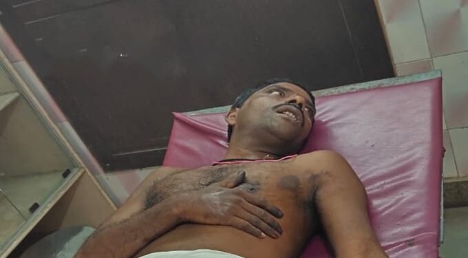 ବରଗଡ଼ ସହରେ ଏସିଡ୍‌ ମାଡ଼ ; ୫ ଗୁରୁତରଙ୍କୁ ଭିମସାରରେ ଭର୍ତ୍ତି