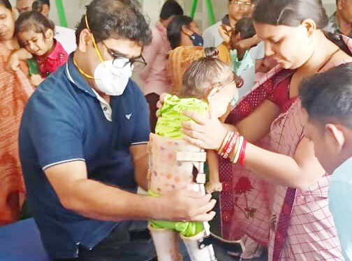 ଶିଶୁ ସ୍ବାସ୍ଥ୍ୟ କାର୍ଯ୍ୟକ୍ରମ : ୮୦ ଜଣଙ୍କୁ କୃତ୍ରିମ ଅଙ୍ଗ ପ୍ରତ୍ୟଙ୍ଗ ପ୍ରଦାନ