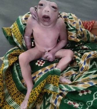 ଡ଼ାକ୍ତରଖାନାରେ ଅଦ୍ଭୁତ ଶିଶୁ କନ୍ୟାର ଜନ୍ମ
