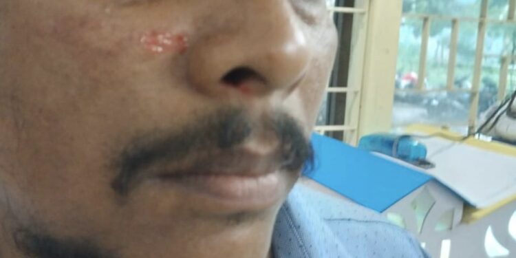 ଟିପିଏସଓଡିଏଲ ଭିଜିଲାନ୍ସ କର୍ମଚାରୀଙ୍କୁ ଆକ୍ରମଣ : ଥାନାରେ ଏତଲା