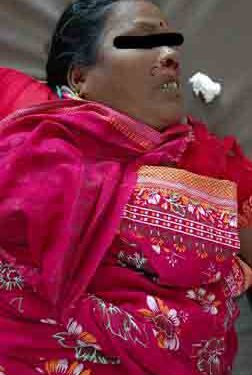 ମୋଟର ସାଇକେଲରୁ ଖସିପଡ଼ି ମହିଳା ମୃତ