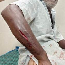 ରାସ୍ତା ପାର୍ଶ୍ଵରେ ମାଛ ବ୍ୟବସାୟ : ଆମିଷ ବଜାର ପାଲଟିଛି ମଦ୍ୟପାନ ସ୍ଥଳୀ