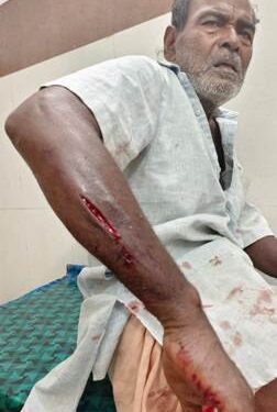 ରାସ୍ତା ପାର୍ଶ୍ଵରେ ମାଛ ବ୍ୟବସାୟ : ଆମିଷ ବଜାର ପାଲଟିଛି ମଦ୍ୟପାନ ସ୍ଥଳୀ