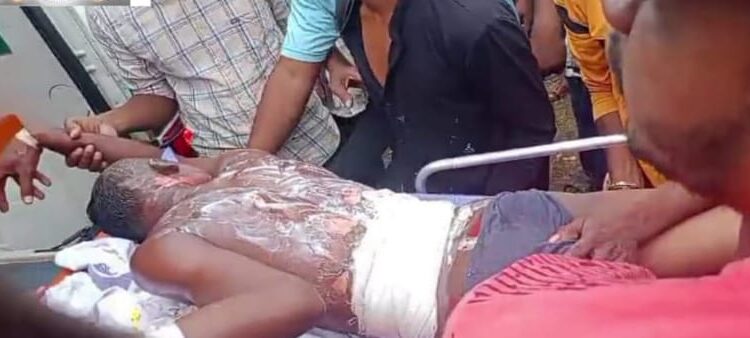 ବିଦ୍ୟୁତ ଆଘାତରେ ଯୁବକ ଗୁରୁତ୍ବ