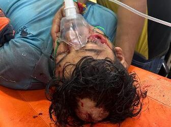 ସଂଘବଦ୍ଧ ଆକ୍ରମଣରେ ଯୁବକ ଗୁରୁତର