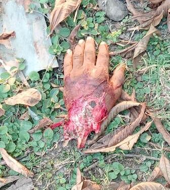 କଟା ହାତ ପାପୁଲି ଉଦ୍ଧାର – ଖୋର୍ଦ୍ଧା ଜିଲ୍ଲା