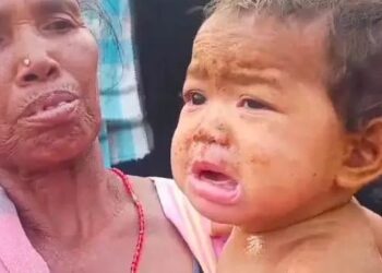 ମୋହନାରେ ମିଳିମିଳା ଆତଙ୍କ – ୧୯ ଶିଶୁ ଆକ୍ରାନ୍ତ
