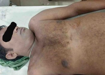 ବଜ୍ରପାତରେ ମଇଁଷି ଚରାଳି ସହ ୨ ମାଙ୍କଡ ମୃତ – ଜଣେ ମହିଳା ଗୁରୁତର