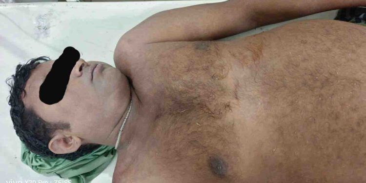 ବଜ୍ରପାତରେ ମଇଁଷି ଚରାଳି ସହ ୨ ମାଙ୍କଡ ମୃତ – ଜଣେ ମହିଳା ଗୁରୁତର