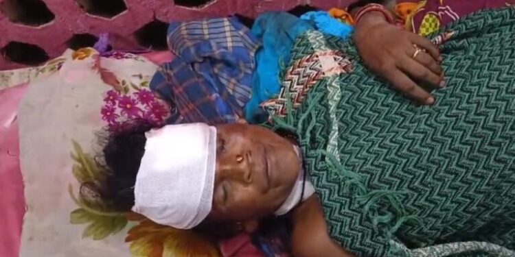 ଜ୍ବାଇଁ ର ଟାଙ୍ଗିଆ ଚୋଟ ରେ ଶାଶୁ ଗୁରୁତର