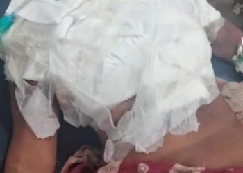 ସ୍ତ୍ରୀ ଉପରେ ଗରମ ପାଣି ଢାଳିଦେଲା ସ୍ୱାମୀ ସ୍ତ୍ରୀ ଗୁରୁତର