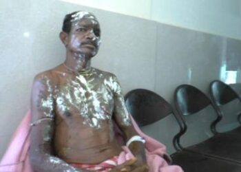 ଘରେ ଶୋଇଥିବା ବେଳେ ଏସିଡ ମାଡ଼ : ବାପା ପୁଅ ଗୁରୁତର