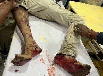 ପୁର୍ବ ଶତ୍ରୁତାକୁ କେନ୍ଦ୍ର କରି ରାଜସୁନାଖଳାରେ ଫୁଟିଲା ବୋମା, ଯୁବ ବ୍ୟବସାୟୀ ଗୁରୁତର ଆହତ