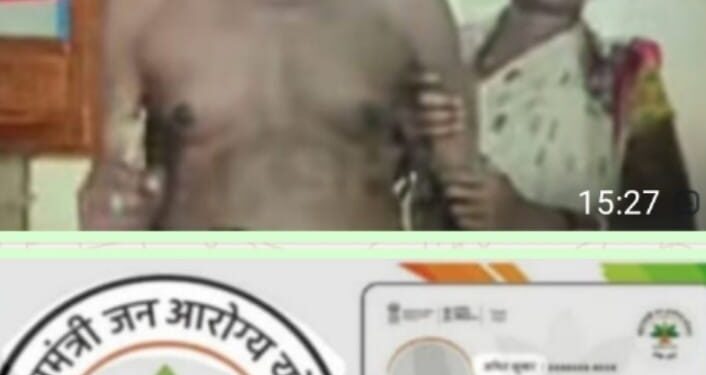 ଆୟୁଷ୍ମାନ ସ୍ବାସ୍ଥ୍ୟକାର୍ଡ କାମରେ ଲାଗୁନି, ଗଜପତିର ଯକୃତ ରୋଗୀ ଆନ୍ଧ୍ରରେ ନିଜସ୍ୱ ଖର୍ଚ୍ଚରେ ଚିକିତ୍ସା କରିବା ପାଇଁ ବାଧ୍ୟ ହେଲେ