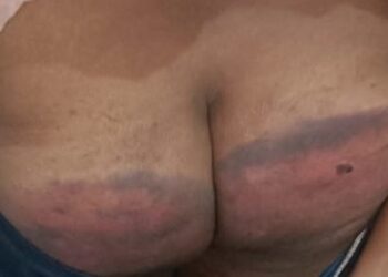 ରଣପୁର ଅବକାରୀ ହାଜତରେ ପୁଅ ଓ ଦୃଷ୍ଟିହୀନ ବାପ ଙ୍କୁ ମାଡ଼ ଘଟଣା ….