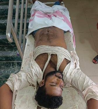 ଅପେରା ପରିବେଷଣ ବେଳେ ଅଘଟଣ – ବିଦ୍ୟୁତ୍ ଆଘାତରେ ଯୁବକଙ୍କ ମୃତ୍ୟୁ