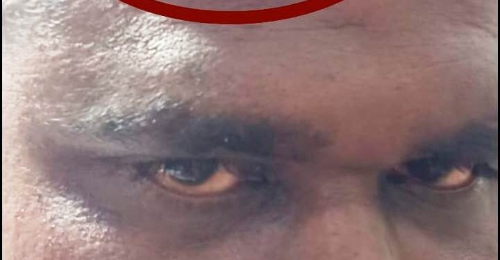 ବିଦ୍ୟାଳୟ ସନ୍ନିକଟ ସମ୍ବେଦନ ଶୀଳସ୍ଥାନରେ ବେଆଇନ୍ ବ୍ୟବସାୟୀଙ୍କ ପ୍ରତି ଚଢ଼ାଉ ହେଉନାହିଁ କାହିଁକି ..?