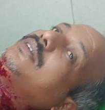 ଫୁଲଚାଷୀଙ୍କ ତଣ୍ଟି କାଟି ହତ୍ୟା ଉଦ୍ୟମ, ଅଜଣା ଦୁର୍ବୃତ୍ତ ଚମ୍ପଟ